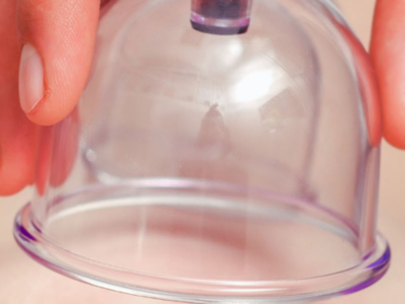 Cupping Therapy Massage Course London Img