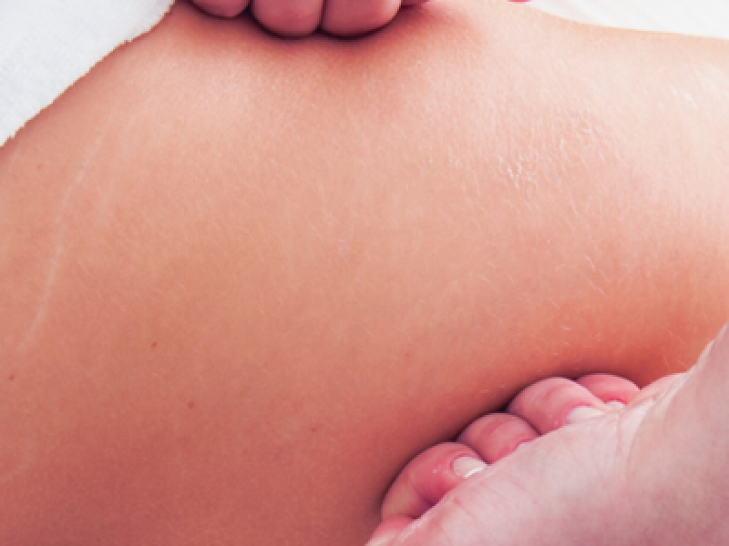 Massage for Cellulite & Anti-Cellulite Massage Course London Img